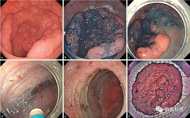 微信(xin)圖片_20191122100729.jpg 微信(xin)圖片_20191122100729.jpg